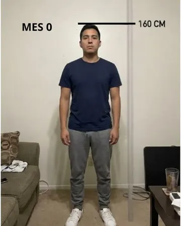 Antes: la diferencia de estatura marcada con láser