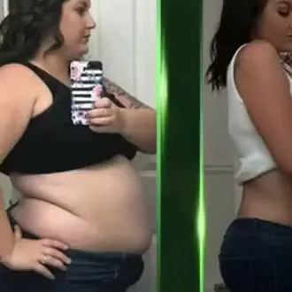 Barriga inflamada y dura